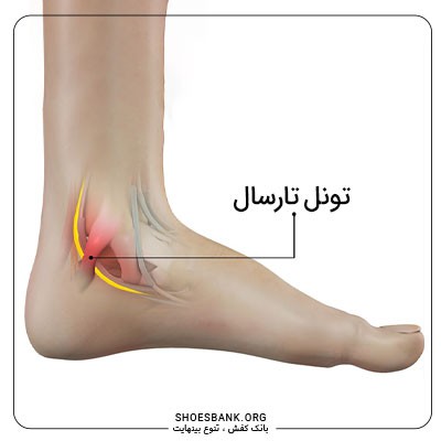 تونل تارسال
